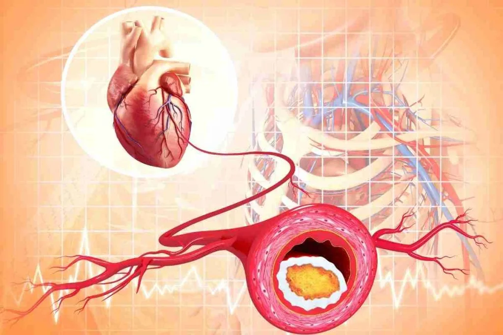 cirurgia-da-veia-aorta-do-coracao