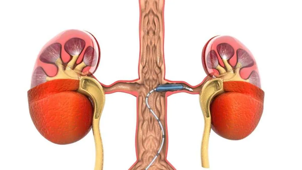 Novas recomendações doença arterial coronariana