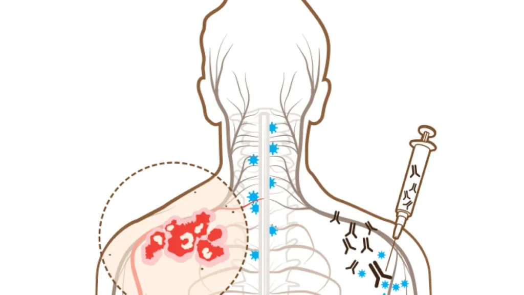 Canetas emagrecedoras elevam risco de herpes-zóster, aponta estudo Canetas emagrecedoras elevam risco de herpes-zóster, aponta estudo