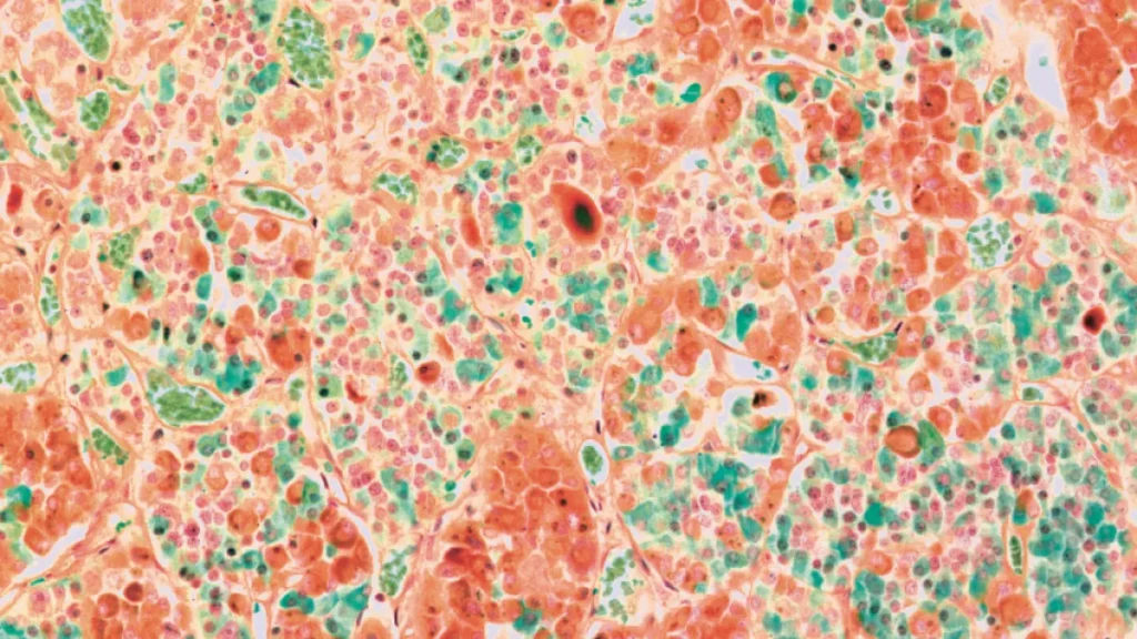 Hipófise: a glândula que comanda seus hormônios